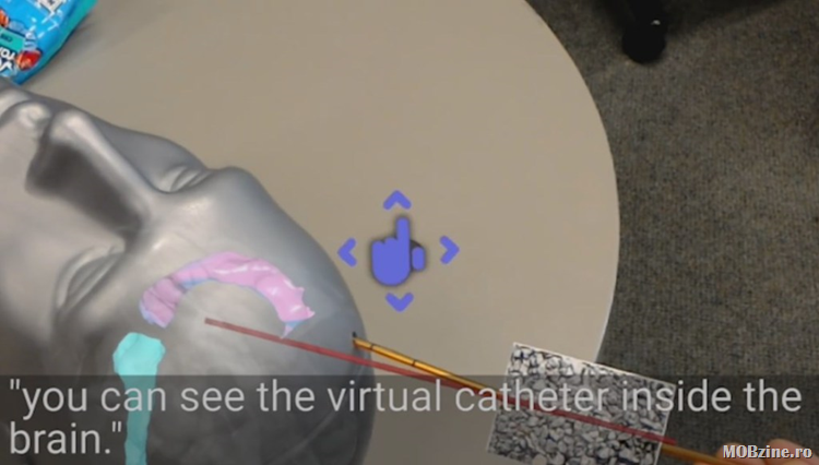 Hololens folosit ca suport AR pentru operatii pe creier