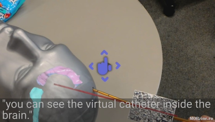 Hololens_brain