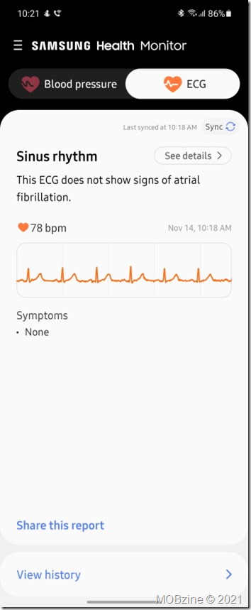 Screenshot_20211114-102100_Samsung Health Monitor
